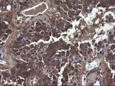 Immunohistochemistry: COMMD1 Antibody (OTI2E2) [NBP2-46331]