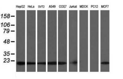 Western Blot: COMMD1 Antibody (OTI2E2) [NBP2-46331]