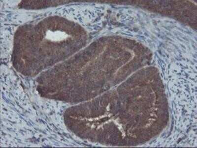 Immunohistochemistry: COMMD1 Antibody (OTI1F2) - Azide and BSA Free [NBP2-72419]