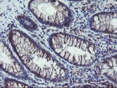 Immunohistochemistry: COMMD1 Antibody (OTI1F2) - Azide and BSA Free [NBP2-72419]
