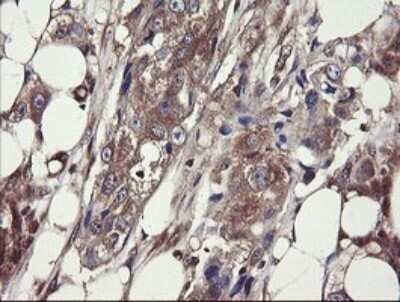 Immunohistochemistry: COMMD1 Antibody (OTI2E2) - Azide and BSA Free [NBP2-72418]