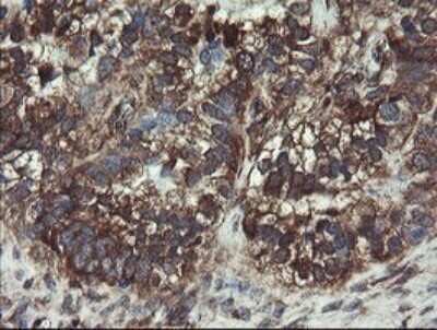 Immunohistochemistry: COMMD1 Antibody (OTI2E2) - Azide and BSA Free [NBP2-72418]