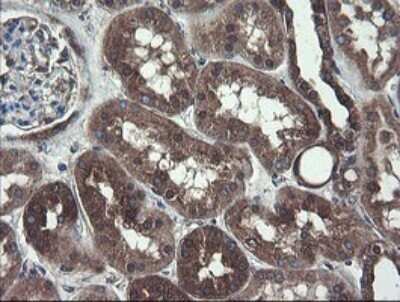 Immunohistochemistry: COMMD1 Antibody (OTI2E2) - Azide and BSA Free [NBP2-72418]