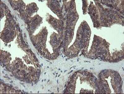 Immunohistochemistry: COMMD1 Antibody (OTI2E2) - Azide and BSA Free [NBP2-72418]