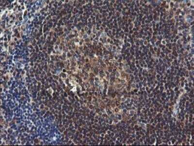 Immunohistochemistry: COMMD1 Antibody (OTI2E2) - Azide and BSA Free [NBP2-72418]