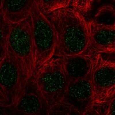 Immunocytochemistry/ Immunofluorescence: COMMD10 Antibody [NBP3-17233]