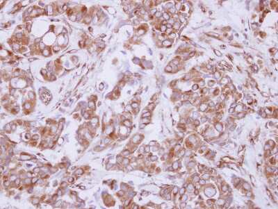 Immunohistochemistry-Paraffin: COMMD10 Antibody [NBP2-15949]