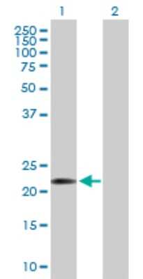 Western Blot: COMMD10 Antibody [H00051397-B01P]
