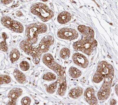 Immunohistochemistry-Paraffin: COMMD3 Antibody [NBP1-88519]