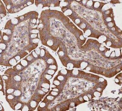 Immunohistochemistry-Paraffin: COMMD3 Antibody [NBP1-88519]