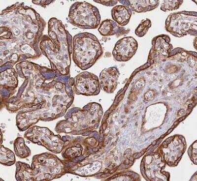 Immunohistochemistry-Paraffin: COMMD3 Antibody [NBP1-88519]