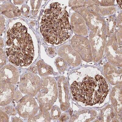 Immunohistochemistry-Paraffin: COMMD3 Antibody [NBP1-88519]