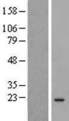 Western Blot: COMMD3 Overexpression Lysate [NBL1-09368]