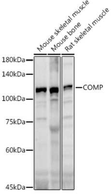 Western Blot: COMP/Thrombospondin-5 AntibodyAzide and BSA Free [NBP2-92658]