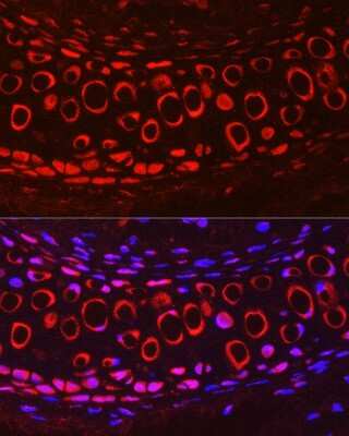 Immunohistochemistry: COMP/Thrombospondin-5 Antibody - Azide and BSA Free [NBP2-92658]