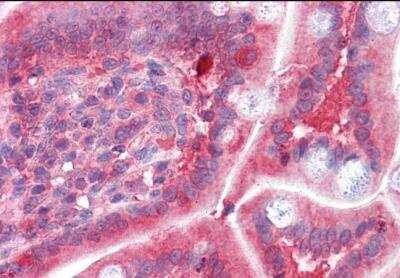 Immunohistochemistry-Paraffin: COMT Antibody [NB100-41387]