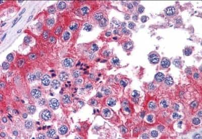 Immunohistochemistry-Paraffin: COMT Antibody [NB100-41387]