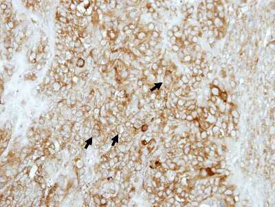 Immunohistochemistry-Paraffin: COMT Antibody [NBP2-15954]