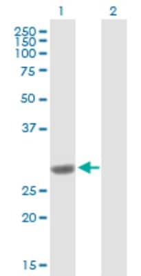 Western Blot: COMT Antibody [H00001312-B01P]