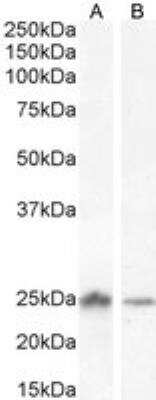 Western Blot: COMT Antibody [NB100-1780]