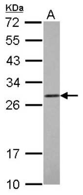 Western Blot: COMT Antibody [NBP2-15954]