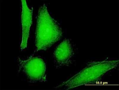 Immunocytochemistry/ Immunofluorescence: COP Antibody [H00114769-B01P]