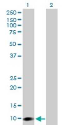 Western Blot: COP Antibody [H00114769-B01P]