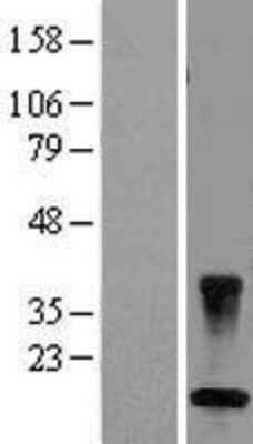 Western Blot: COP Overexpression Lysate [NBL1-09376]