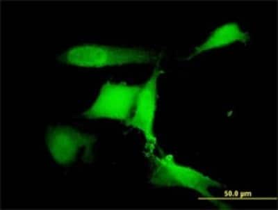 Immunocytochemistry/ Immunofluorescence: COP1 Antibody (1E4) [H00064326-M01]