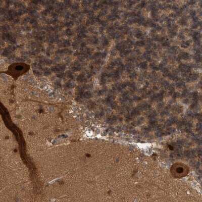 Immunohistochemistry-Paraffin: COP9 Antibody [NBP1-85435]