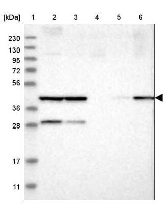 Western Blot: COP9 Antibody [NBP1-85435]