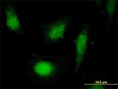 Immunocytochemistry/ Immunofluorescence: COP9 signalosome complex subunit 2 Antibody (4B12) [H00009318-M02]