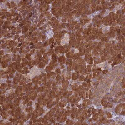 Immunohistochemistry-Paraffin: COPE Antibody [NBP2-38512]