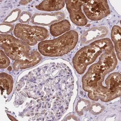 Immunohistochemistry-Paraffin: COPG Antibody [NBP2-58317]