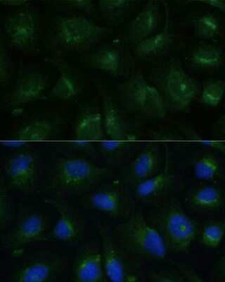 Immunocytochemistry/ Immunofluorescence: COPG2 Antibody - Azide and BSA Free [NBP2-92868]