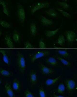 Immunocytochemistry/ Immunofluorescence: COPG2 Antibody - Azide and BSA Free [NBP2-92869]