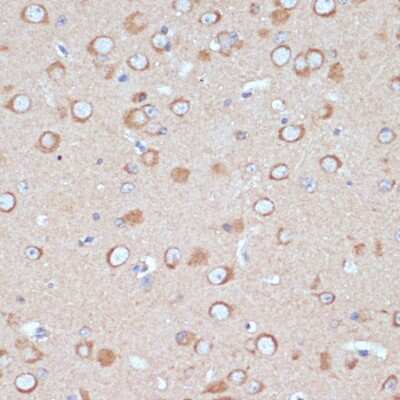 Immunohistochemistry-Paraffin: COPG2 Antibody - Azide and BSA Free [NBP2-92868]