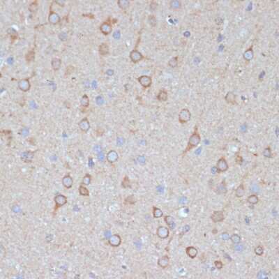 Immunohistochemistry-Paraffin: COPG2 Antibody - Azide and BSA Free [NBP2-92868]