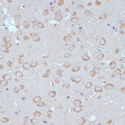 Immunohistochemistry-Paraffin: COPG2 Antibody - Azide and BSA Free [NBP2-92869]