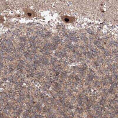 Immunohistochemistry-Paraffin: COPS4 Antibody [NBP1-85434]