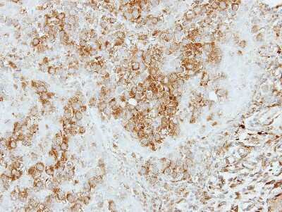 Immunohistochemistry-Paraffin: COPS4 Antibody [NBP2-15961]