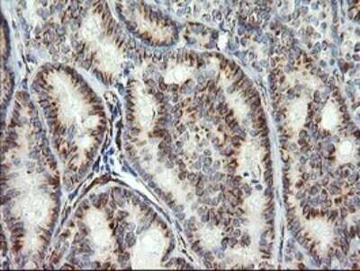 Immunohistochemistry: COPS6 Antibody (OTI4E7) [NBP2-46333]