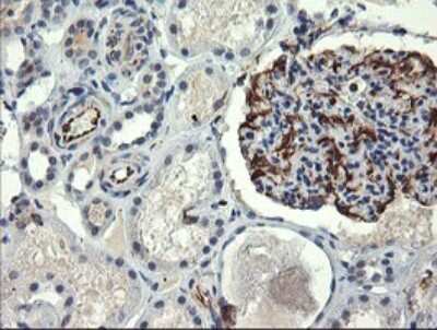 Immunohistochemistry: COPS6 Antibody (OTI4E7) [NBP2-46333]