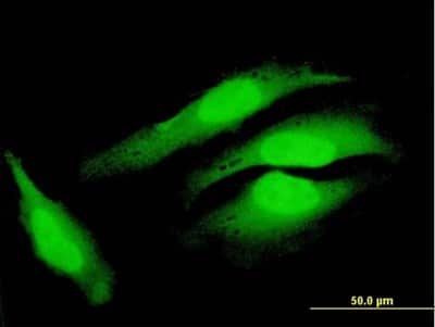 Immunocytochemistry/ Immunofluorescence: COPS8 Antibody [H00010920-B01P]