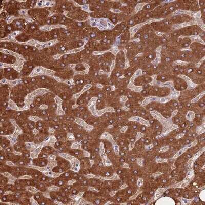Immunohistochemistry-Paraffin: COQ5 Antibody [NBP2-13859]