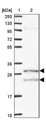 Western Blot: COQ5 Antibody [NBP2-13859]
