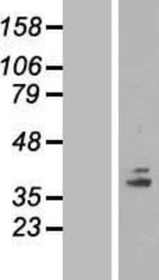 Western Blot: COQ5 Overexpression Lysate [NBL1-09391]