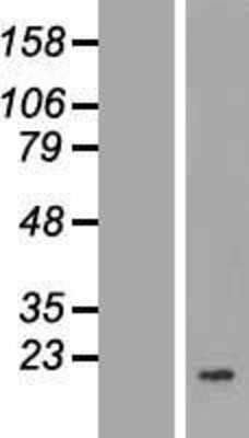 Western Blot: COQ7 Overexpression Lysate [NBP2-07084]