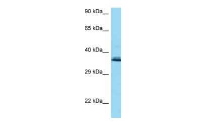 Western Blot: COQ9 Antibody [NBP2-82739]