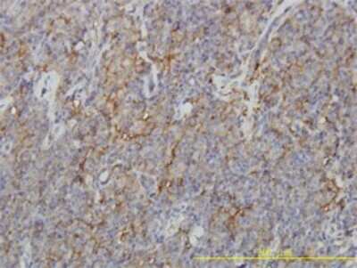 Immunohistochemistry-Paraffin: CORO1B Antibody (1E7) [H00057175-M01]